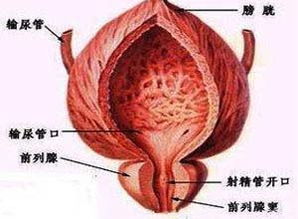前列腺钙化是怎么形成的