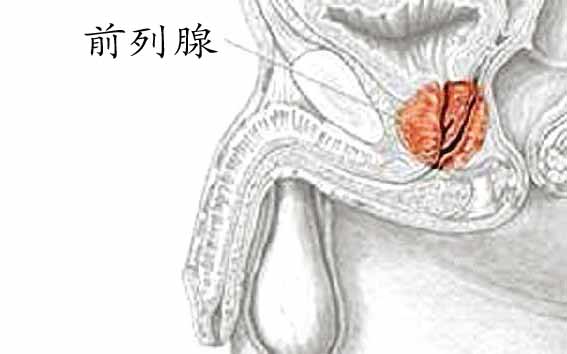 最先进的前列腺囊肿诊断方法