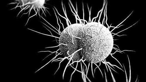 感染淋菌与链球菌有何症状区别?