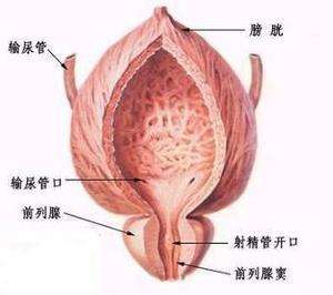 前列腺结核的症状包括什么
