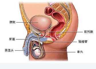 什么是前列腺结核