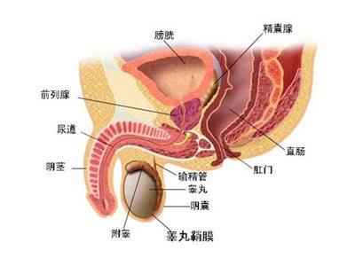 前列腺结石的病因及治疗和预防