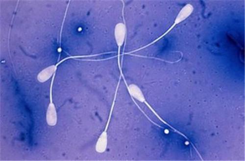 精子异常有以下4种类型，男性要重视起来