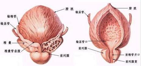 前列腺囊肿的危害和检查及治疗