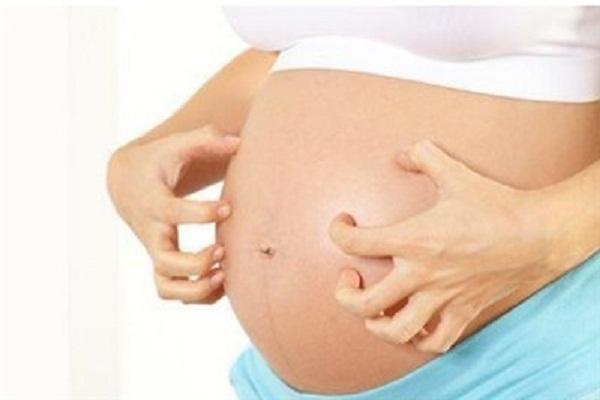 孕妇皮肤瘙痒的症状和原因以及对胎儿的危害