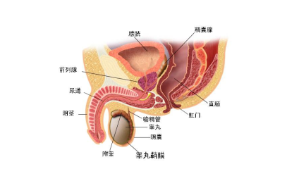 前列腺结石的检查和治疗