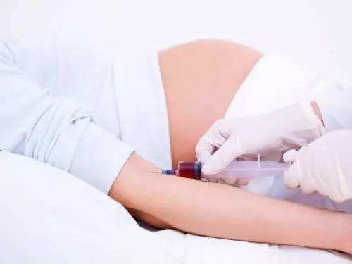在成华地区孕期检查无创DNA的费用多少?