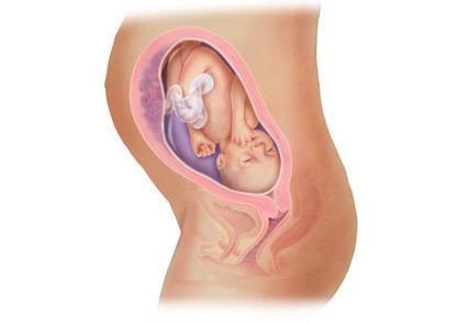 女性泌乳素是什么及泌乳素高不孕的症状和原因