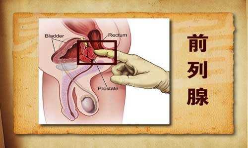 前列腺增生会引起哪些并发症 怎么预防