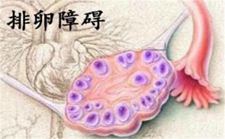 温江中医院能治排卵障碍吗
